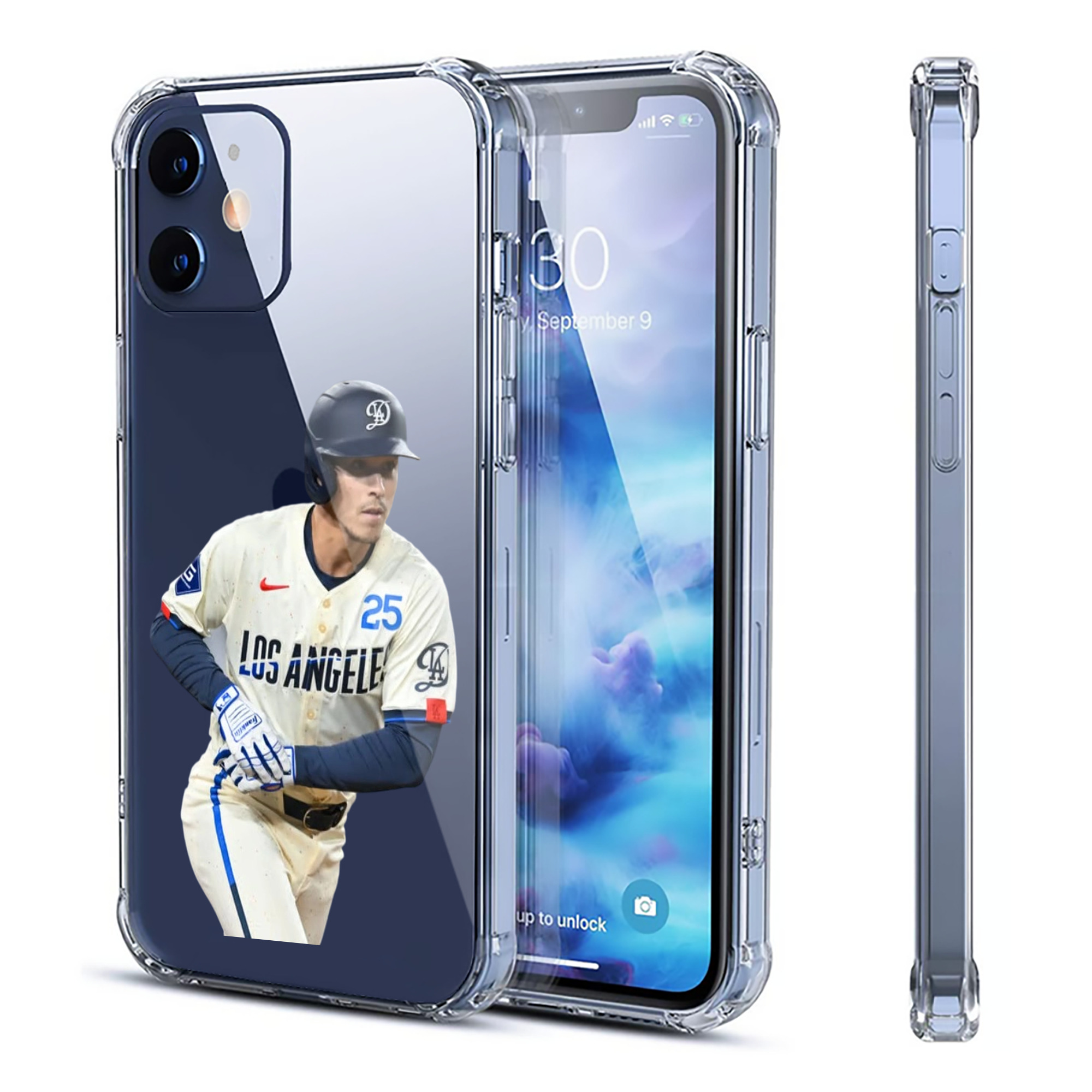  Clear IPhone 12 Case – Soft TPU With UV Print – Enhanced Drop Protection, Precise Fit, Anti-Fingerprint, Customizable Design, Scratch-Resistant, Yellow-Resistant